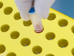 TPP Polar Cryogenic Tubes